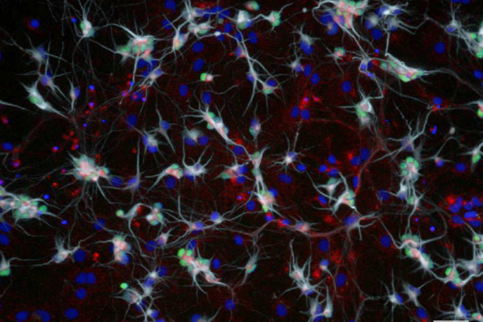 Foto-als-info-2017-05-25 sma-motor-neurons